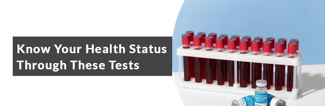 Know Your Health Status Through These Tests
